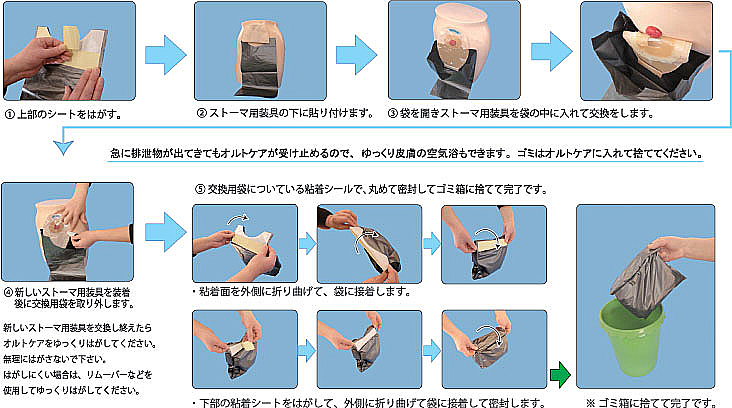 【オルトケア】ストーマ交換用品
