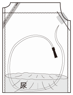 カテーテルが全て入っている状態