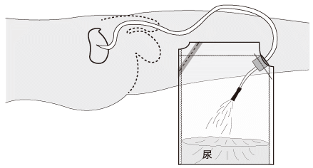 逆止弁構造になっているので、横にして置いても尿もれしません